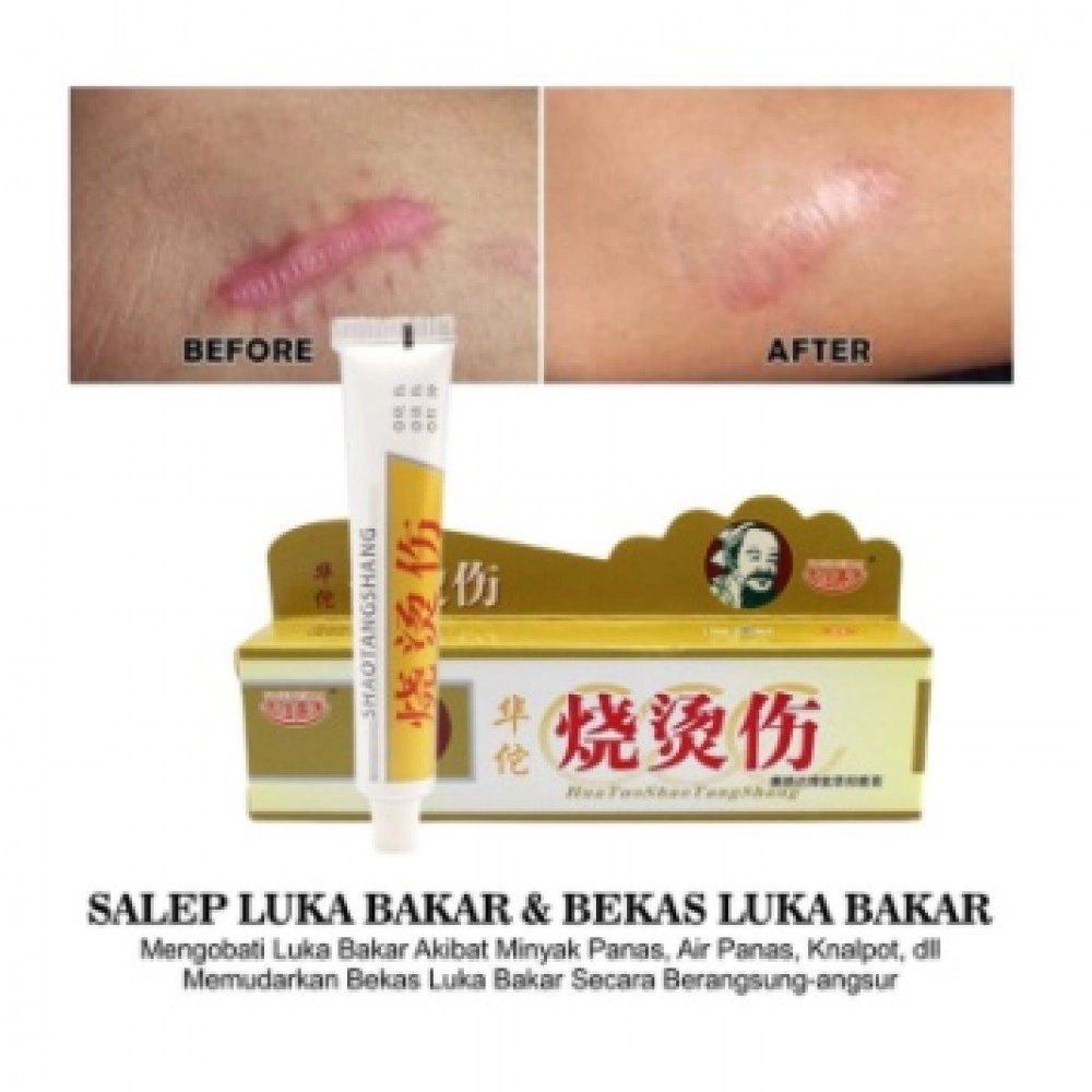 Salep Huang Tuo/penghilang bekas luka&Luka bakar/jerawat