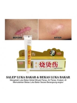 Salep Huang Tuo/penghilang bekas luka&Luka bakar/jerawat