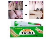 Cream obat kaki pecah dan tumit kering