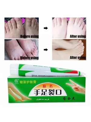 Cream obat kaki pecah dan tumit kering