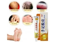 Salep kaki pecah pecah dan tumit kaki pecah