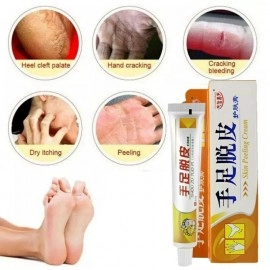 Salep kaki pecah pecah dan tumit kaki pecah