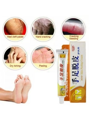 Salep kaki pecah pecah dan tumit kaki pecah