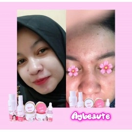 Paket Complit Aybeaute+Serum Glow
