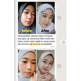 Aybeaute Glow Serum  Aybeaute Glow Serum