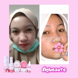 Aybeaute Glow Serum  Aybeaute Glow Serum