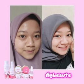 Paket Basic Aybeaute Cream Pemutih Wajah| Jerawat | BPOM  Paket Basic Aybeaute Cream Pemutih Wajah| Jerawat | BPOM